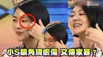 娱乐圈爆料家暴男小说,家暴男星的隐秘生活  第2张